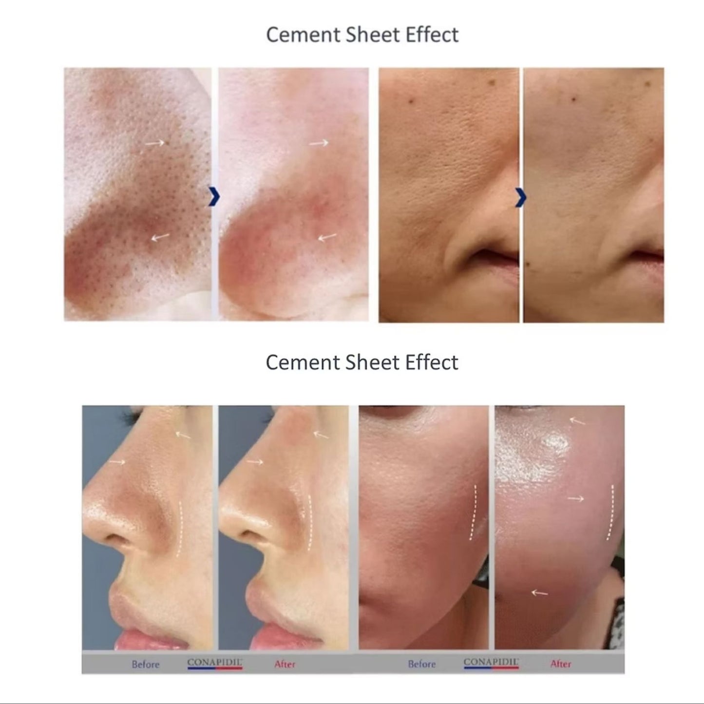 Conapadil Cemensheet Masks ( 5 Pack )