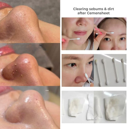 Conapadil Cemensheet Masks ( 5 Pack )