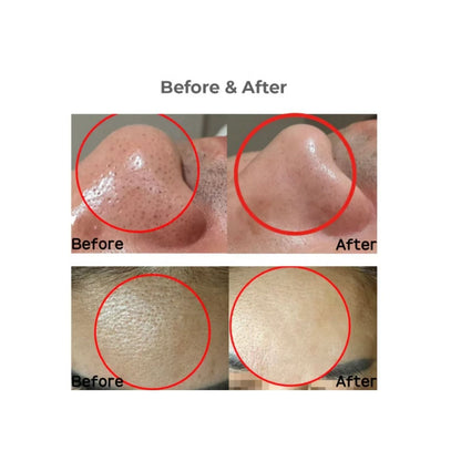 Conapadil Cemensheet Masks ( 5 Pack )